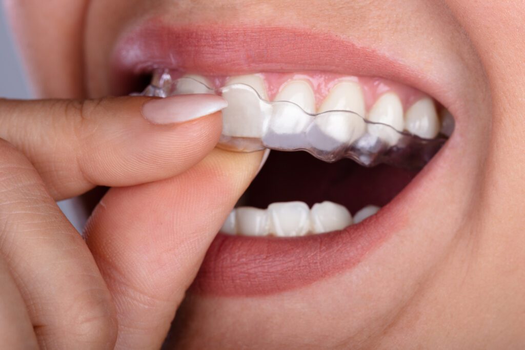 IPO Dental -