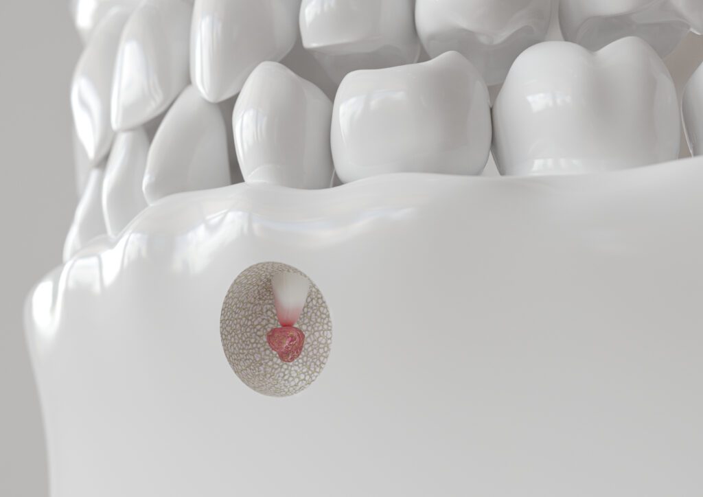 IPO Dental -