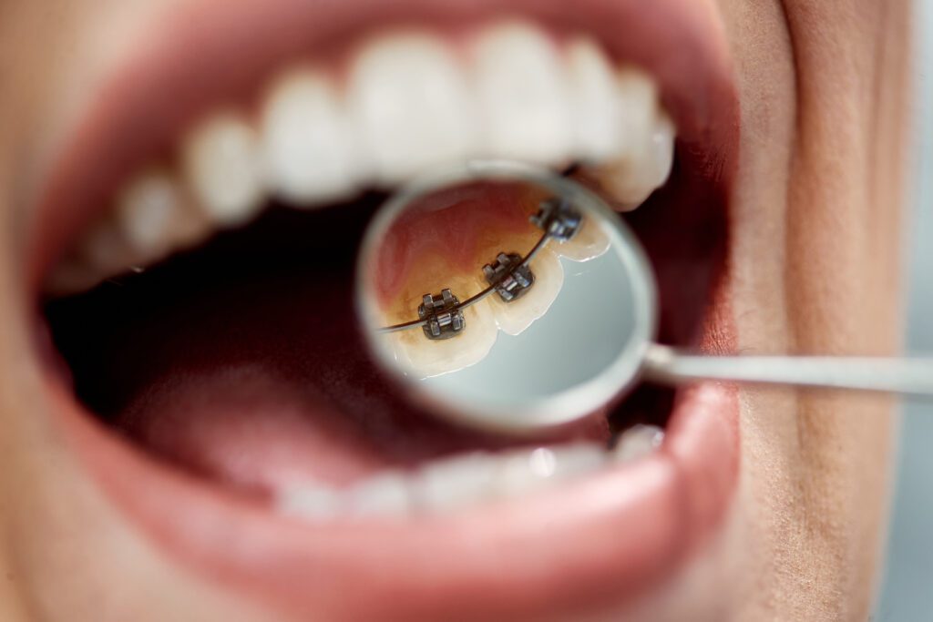 IPO Dental -