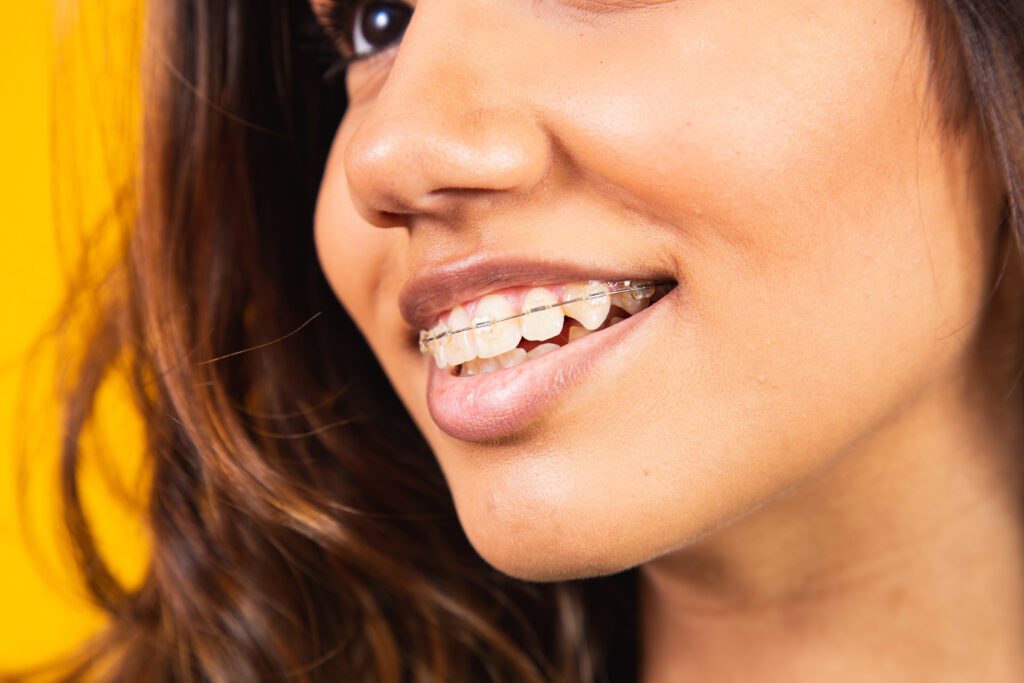 IPO Dental -
