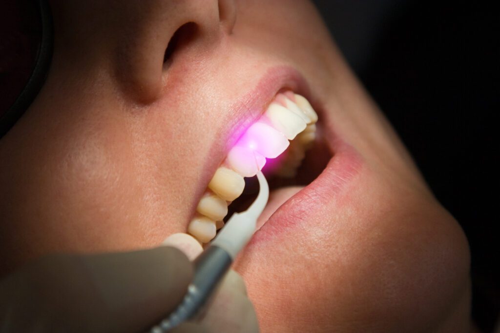 IPO Dental -