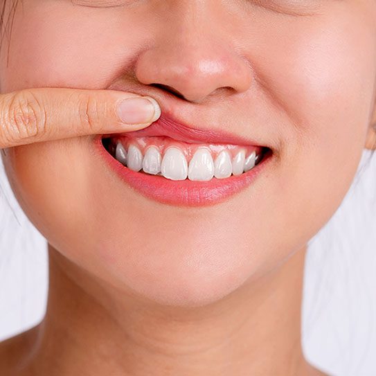 IPO Dental -