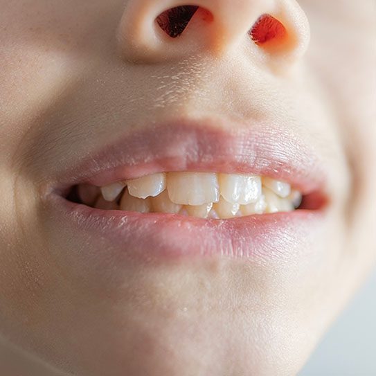 IPO Dental -